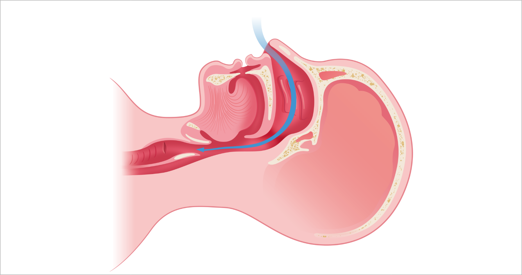 マウスピースの仕組み